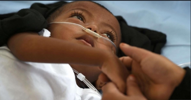 وكالات صحية: كل 39 ثانية يموت طفلا بسبب الالتهاب الرئوي